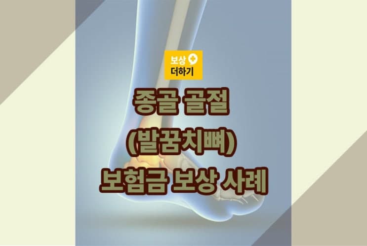 종골 골절(발꿈치뼈) 내고정술 영구장해 보험금 보상 사례