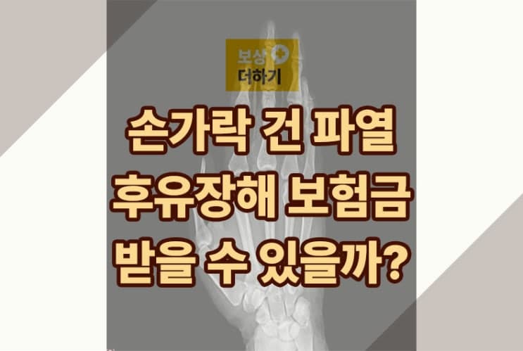 손가락 건(힘줄) 파열, 후유장해 보험금 받을 수 있을까?