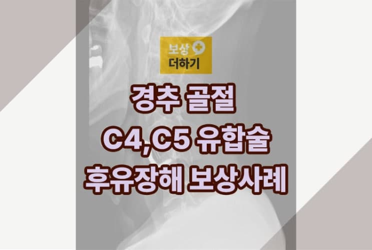 경추 C4 C5 골절 유합술 - 개인보험 후유장해 보상 사례