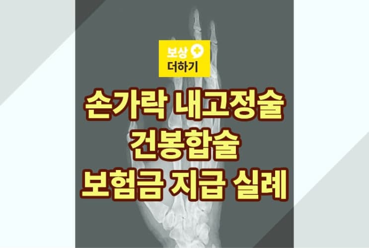손가락 내고정술, 건봉합술 - 보험에서 이렇게 받을 수 있어요(실례)