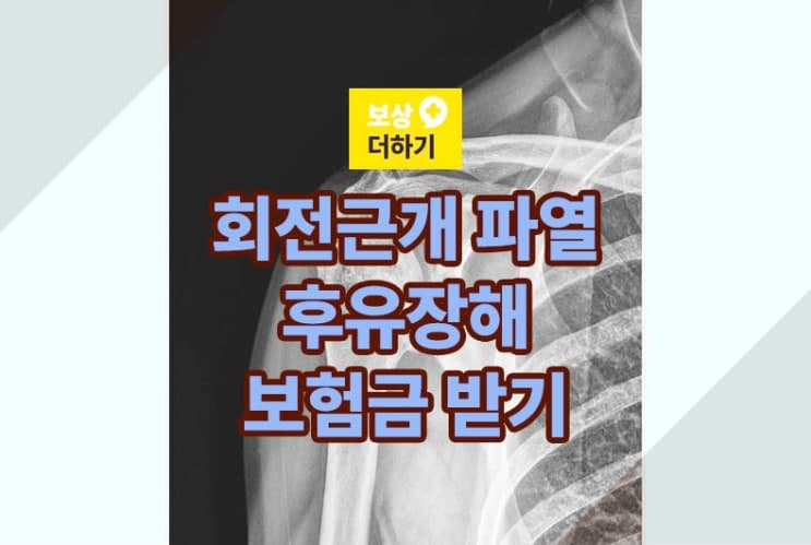 회전근개 파열 후유장해 보험금 제대로 받기(feat.사례)