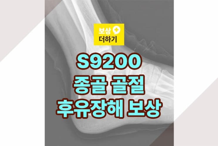 낙상사고 S9200 종골 골절 진단, 후유장해 보상받기
