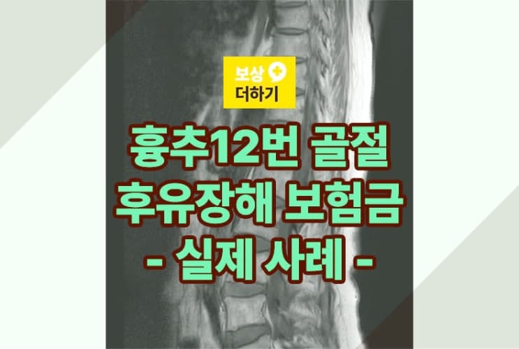 제12 흉추 골절 후유증 보험금 얼마나 받을까 - 실제 사례