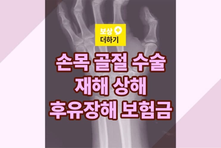 손목 골절 수술, 재해 상해 후유장해 보험금 모두 받으세요