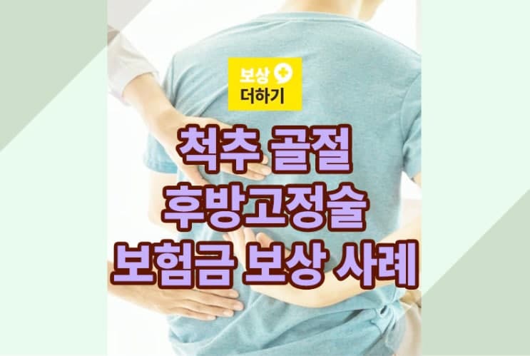 척추 골절 후방 기기 고정술(요추) 후유장해에 의한 보험금 얼마