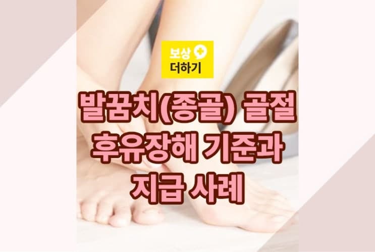 발꿈치(종골) 골절, 개인보험 후유장해에 해당되는 기준과 지급 사례