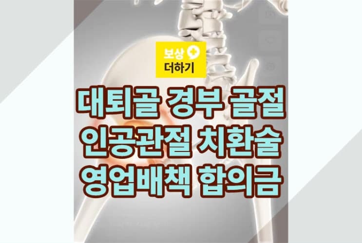 낙상사고 S72090 대퇴골 골절 인공관절 전치환술 합의금