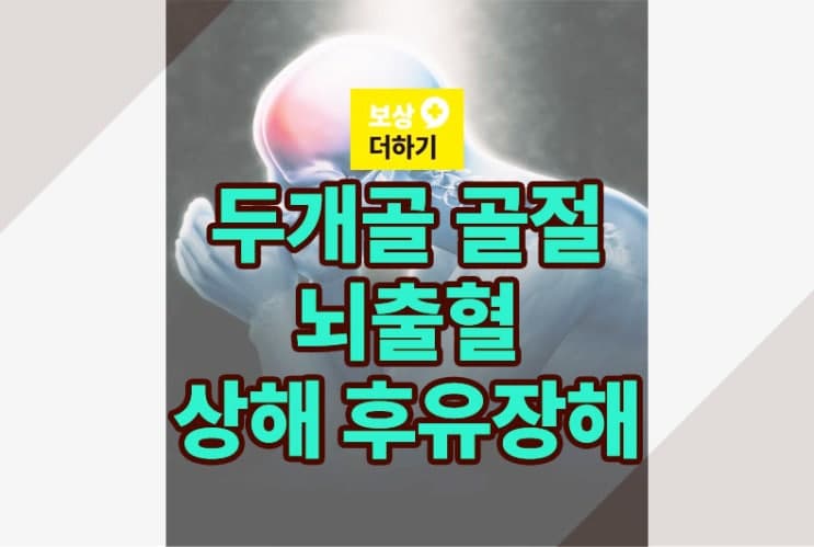 전두골(두개골) 골절 후 뇌출혈, 개인보험 상해 후유장해 보상 사례