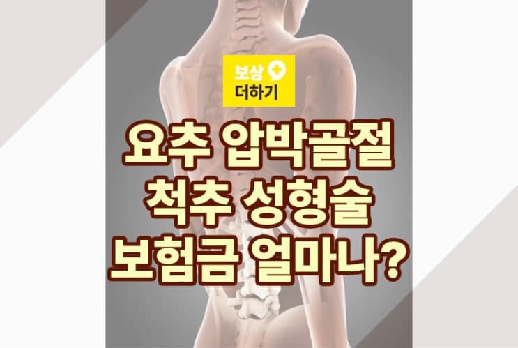 경피적 척추 성형술 (요추 2번 압박골절) 보험금 얼마나 받을까