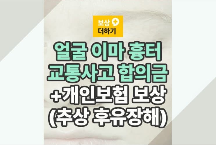 얼굴 이마 흉터 보상, 교통사고 및 개인보험 (안면부 열상 추상장해)