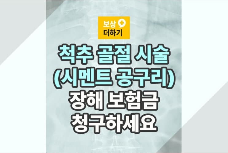 척추 시멘트 공구리 시술 (흉추 골절) 장해 보험금 청구하세요