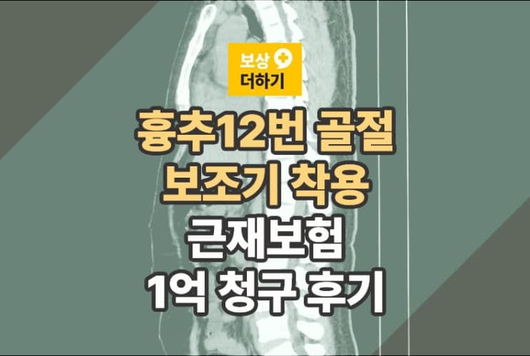 흉추12번 압박골절, 산재 외 추가 보상 (근재보험1억 청구사례)