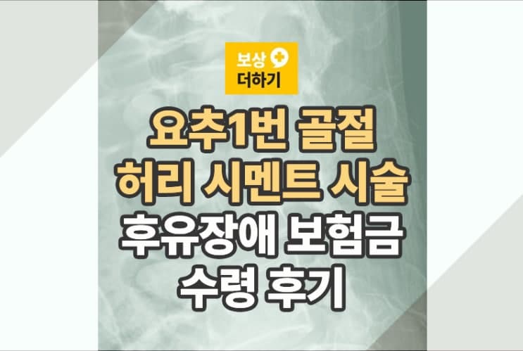척추골절 시멘트 시술 보험금 청구 8500만 원 보상후기(L1)