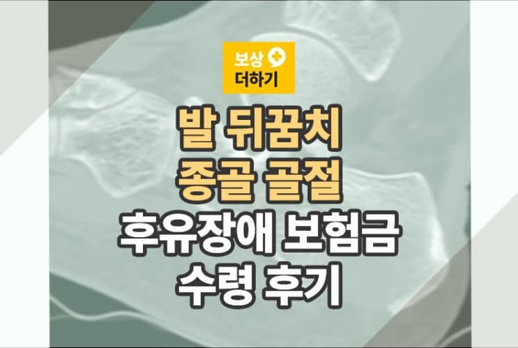 종골골절 수술 후유증 후유장해 청구후기 (1,100만 원 보상비결)