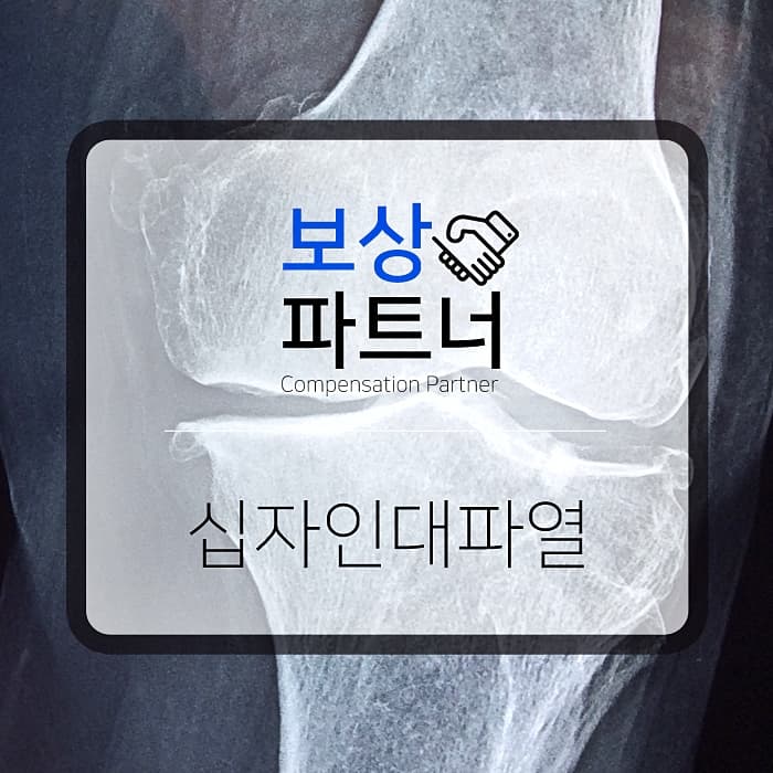 십자인대파열 진단 받았다면, 후유장해 보상 받으세요!
