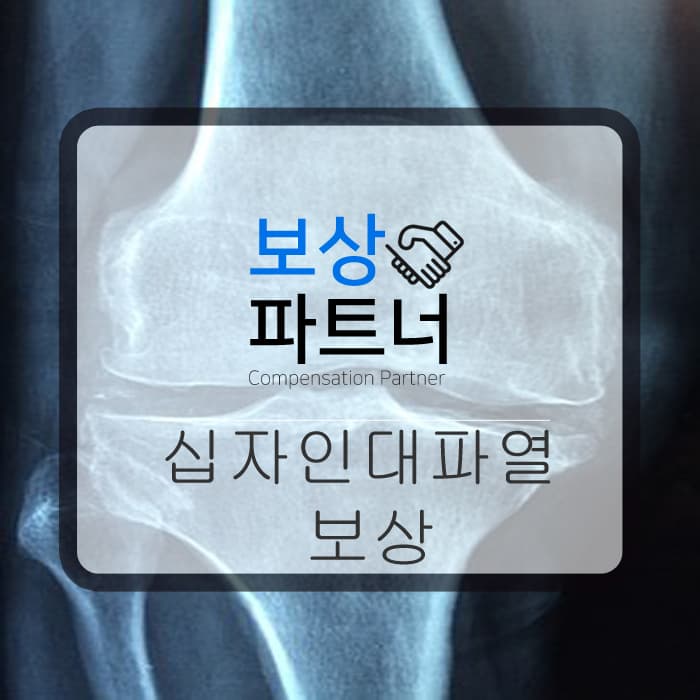 십자인대파열 동요 후유장해 보상