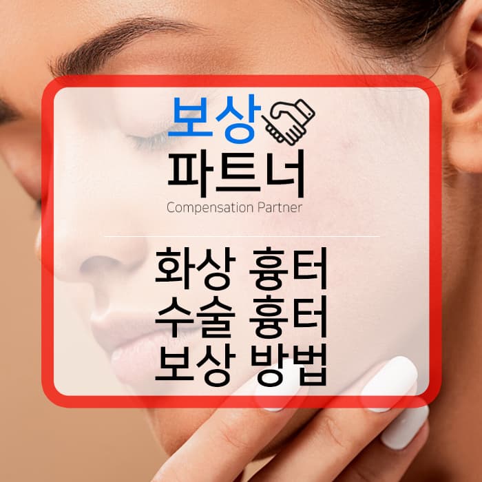 얼굴흉터, 화상흉터, 수술흉터 보험보상방법
