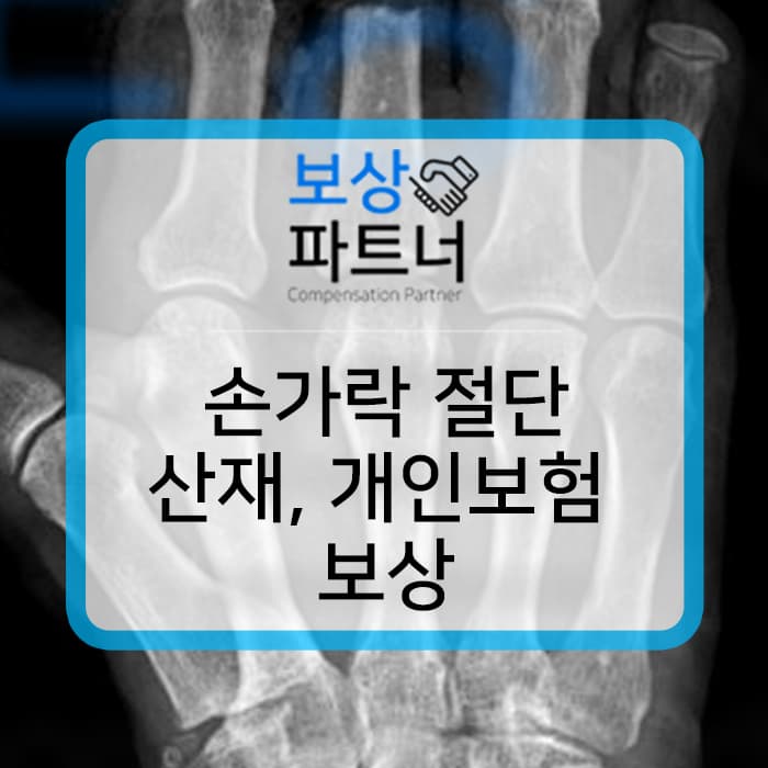 손가락 절단 산재 장해등급과 개인보험 후유장해 처리 사례