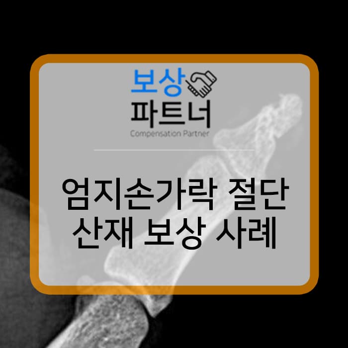 엄지손가락 절단, 산재 장해등급 13급 보상 사례