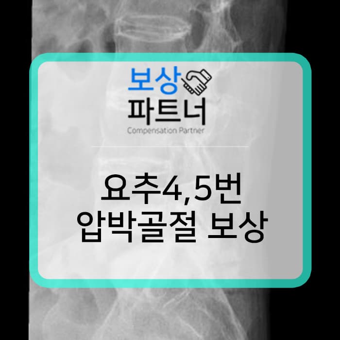 요추5번 압박골절 허리보조기 착용, 교통사고로 인한 사고 실제 보상 사례