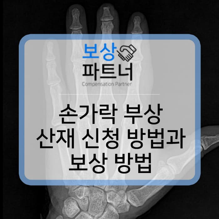 일하다 롤러에 끼임, 손가락 봉합수술, 산재 신청 방법 알아보자!