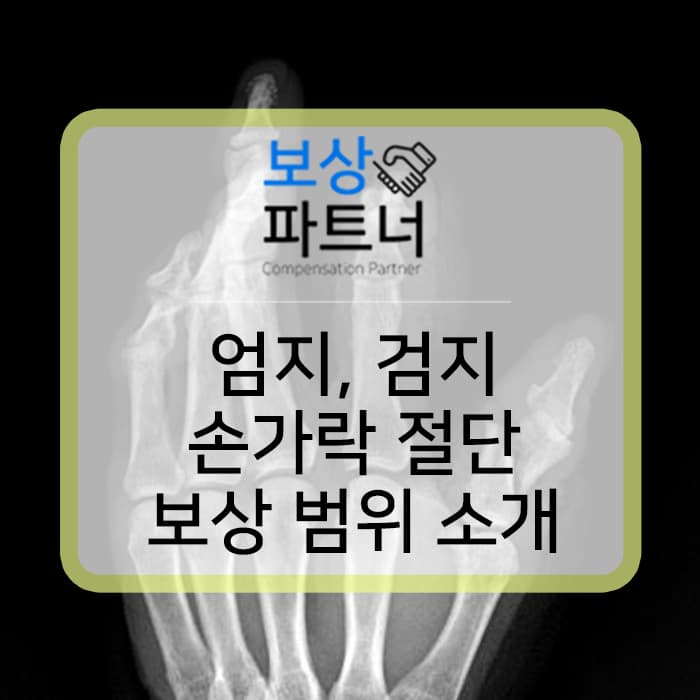 엄지와 검지 손가락 절단 사고 산재와 개인보험 보상 방법