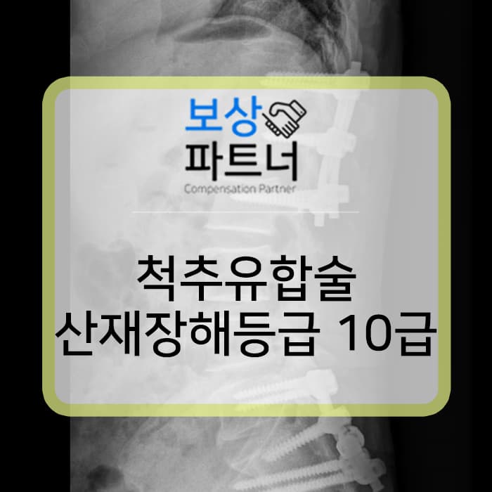 허리뼈골절, 요추1번 척추고정술 산재 장해등급 10급 보상 사례