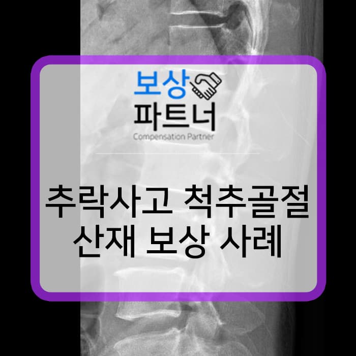 2미터 추락사고로 요추1번 척추압박골절, 산재보상금