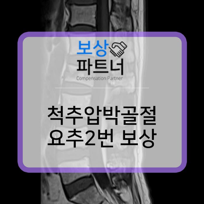 허리뼈 골절, 요추2번(척추압박골절) 약 9,000만원 후유장해 보험금 보상 사례