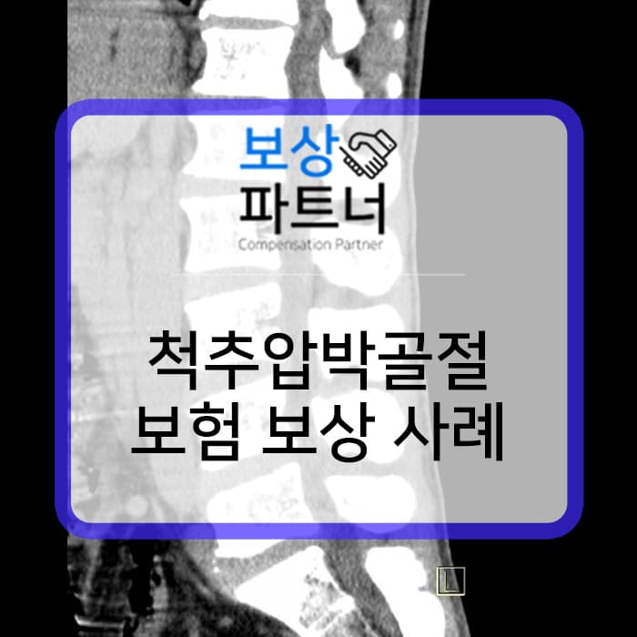 허리뼈 골절 후유장해(후유장애) 보험 보상 방법
