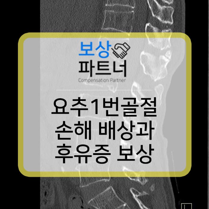개물림 사고 요추골절, 1번척추 압박골절 합의금과 후유증 보상 사례