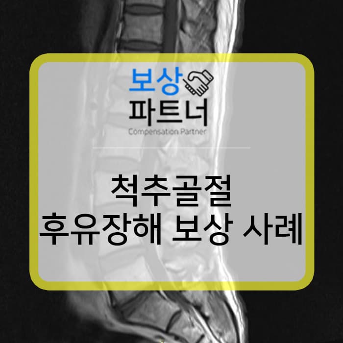 척추 골절 s32020 후유증 보험에서 보상 받은 사례