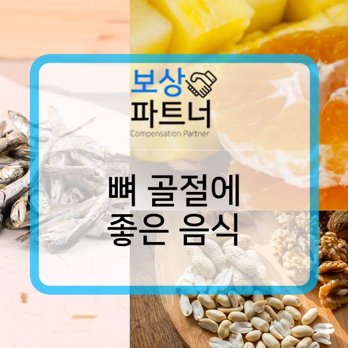 뼈 골절에 좋은 음식