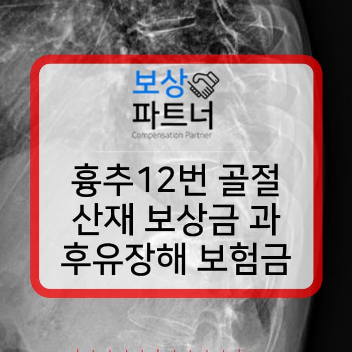 흉추 12번 허리뼈 골절 산재 등급 표와 보험 후유장해 보상 성공 방법