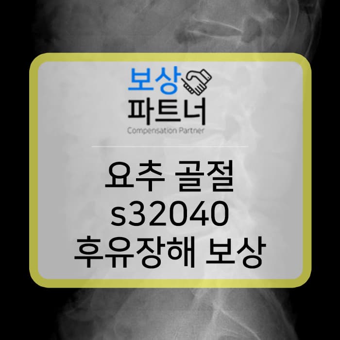 요추골절 S32040 허리 전치6주. 골절진단비말고 후유증(후유장해) 보상 받는 방법