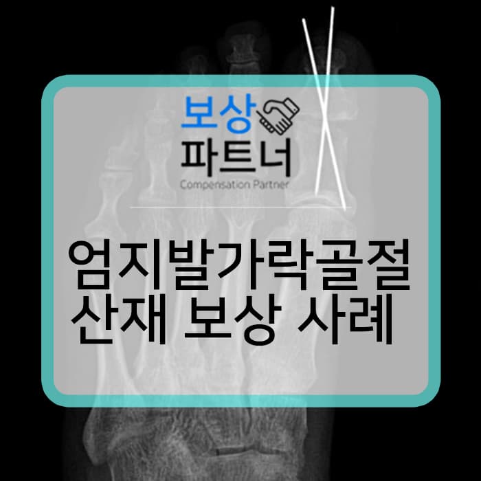 일하다가 엄지발가락 골절 및 절단되었을 때 산재 장해등급은?