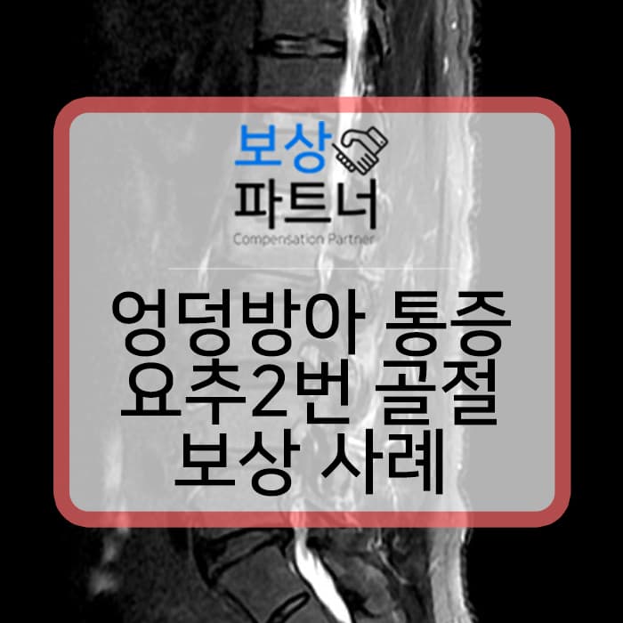 엉덩방아 찧고 시작된 허리통증 요추2번 골절 골절진단비 말고 장해보험금 보상 사례