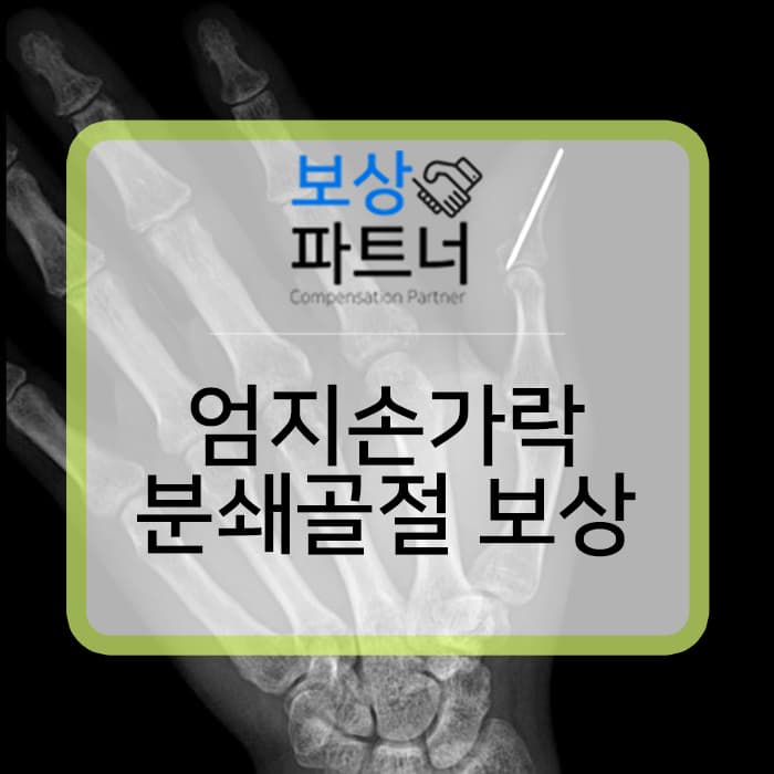 장갑 말림으로 1수지 압궤 절단, 개방성 분쇄골절 S68.00 S682.531 S67.8 S63.4 산재와 일반보험 보상