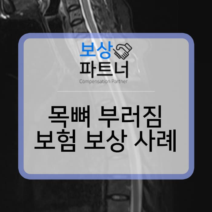 목뼈 부러짐 12주진단 합의금과 일반 개인보험 생손보사 후유장해 추가 보상 사례