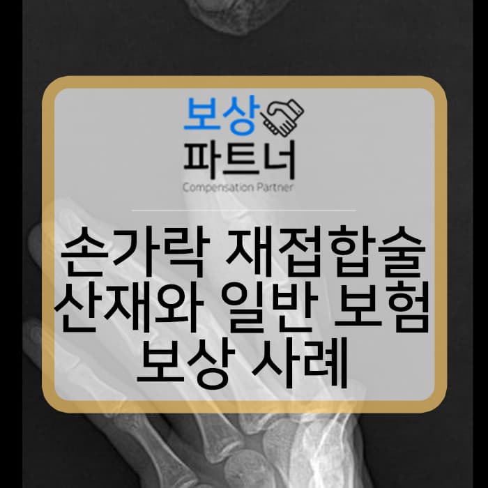 손가락 접합술 6주 진단, 산재와 일반 생손보험 장해 보상 사례