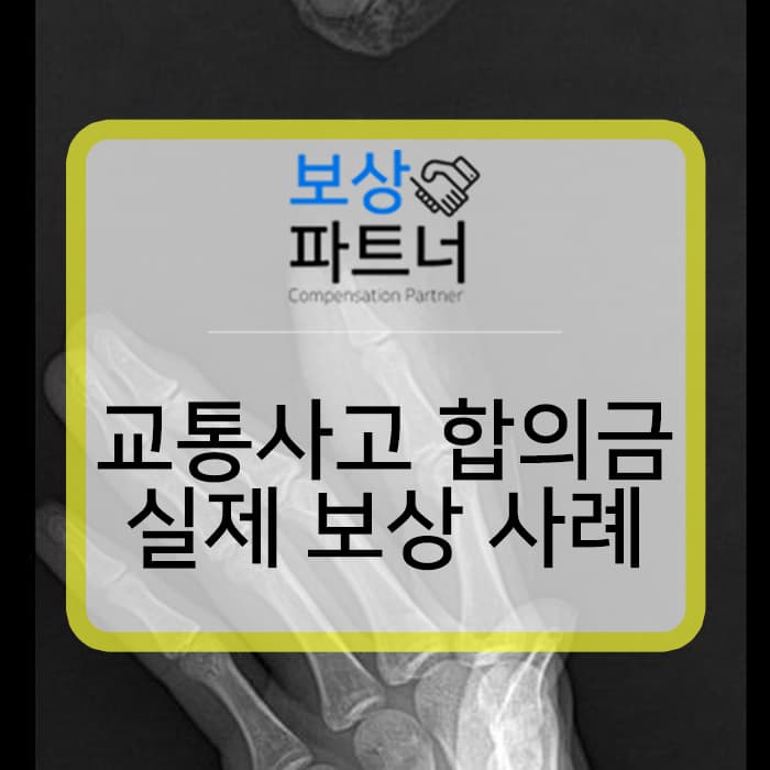 12대 중과실 교통사고 합의요령 있을까요? 실제 처리 사례로 알아보세요!