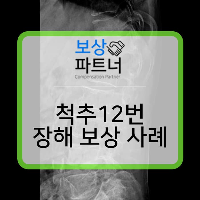 TLSO 보조기 착용중인 흉추12번 척추압박골절 S220 생손 보험 2700만원 보상사례