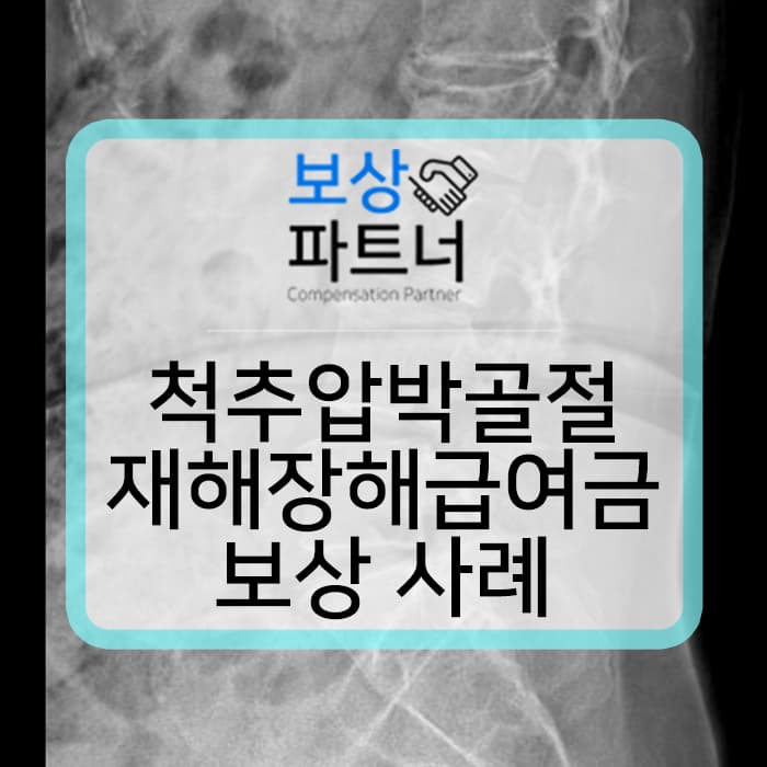 척추압박골절 보존치료 허리보조기 착용 후유장해진단서 발급 후 재해장해급여금 보상 사례