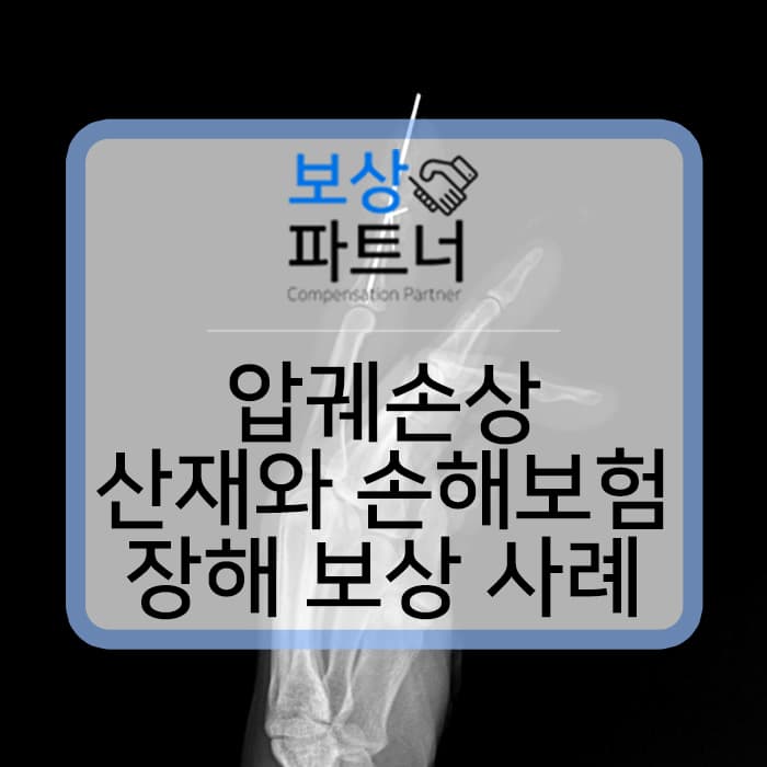 압궤 손상 (crushing injury) 산재보험과 내가 가입한 손해보험 장해 보상 사례