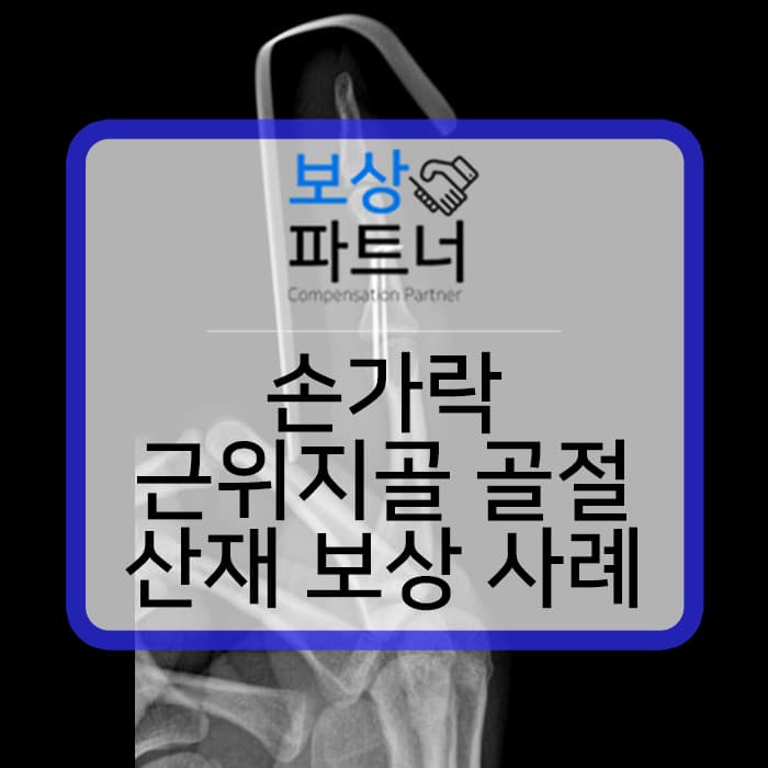 우측 제2수지 손가락 근위지골 개방성 골절 로 수술했다면 산재 보상금은 얼마?