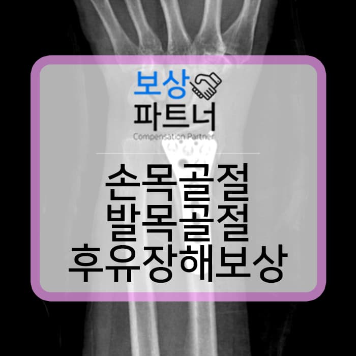 콜리스골절 (colles fracture) 수술 과 외측복사의 골절 s8260 후유장해 보상 사례
