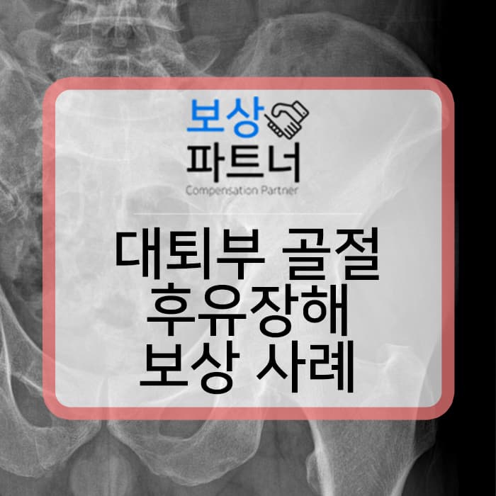 대퇴부 골절 s72090 후유장해 보험 보상 사례