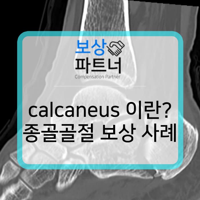1.5M에서 추락 사고 종골 골절(calcaneus) 후유장해 보험금 보상 성공 사례