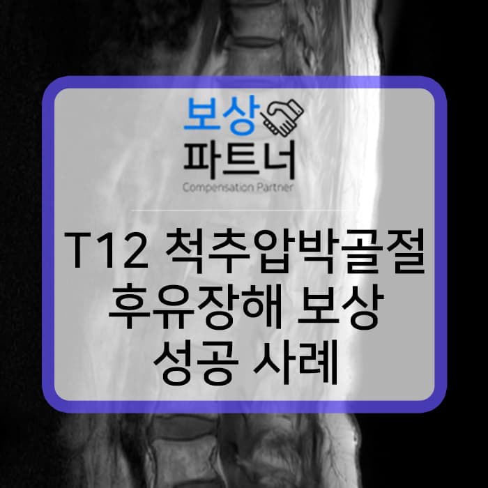 T12 등뼈 (Thoracic vertebrae) , 흉추12번 압박골절 생손보험 상해후유장해, 재해장해 보상 사례