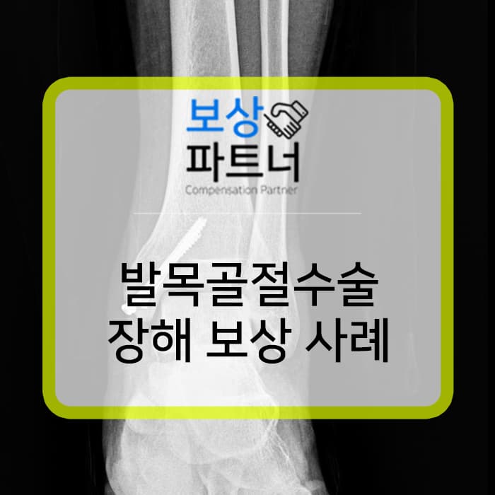 Malleolus? Tibia? 발목 골절 진단 받았다면 장해보상도 받으세요!
